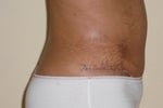 not too high, this is where my pant went up to so he marked it.