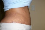 this is the lower side and it matches more with where my pants are.