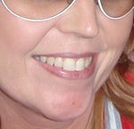 April 2009 - No lipstick because I didn't wan to draw attention to my mouth.