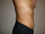 4 weeks post-op