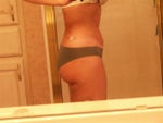 Side Day 2 (swelling has begun)
