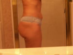 Side Day 14 (still swollen!!)