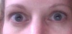 crazy different shaped eyes (looks more uneven when I dont open eyes this wide)