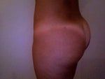 Profile lump