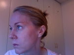 Profile showing smoother, tighter skin around eyes