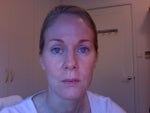 Two months later, photo with no makeup
