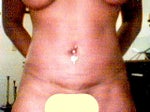 13 days after lipo. my stomach is now beginning to smooth and even out pretty nicely as u can see