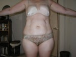 Pre lipo