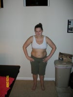 pre op 11/09