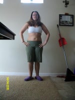 post op 5 days 4/4/10
