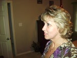 Side view Before surgery..extra skin under neck.