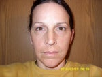 Three months after
