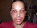 Three days after