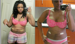 06 March 2010 - Results from Smart Lipo touch up on 22 Feb 2010
