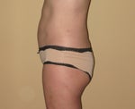 Side 3 months