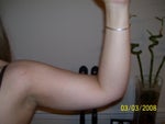 The day before surgery