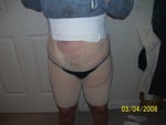A few hours after surgery