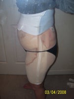 a few hours after surgery