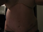 I am extremely swollen, my right side more. You can see a little bit of my waist on the left side. 