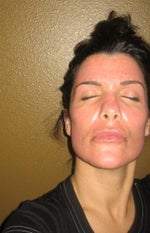 Day 6- pretty red and blotchy...no makeup