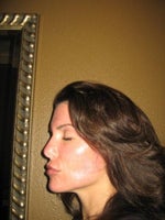 Day 6- Left side of face appears to be healing better