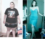 before and after gastric bypass