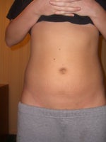 4 weeks- lumpy under the skin but lookin GREAT