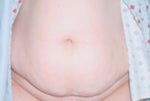 Before surgery picture