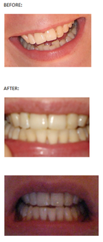 beforeandafter.png