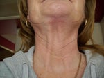 Neck bands do not look attached. 