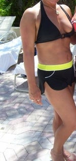 abdomen 16 months after surgery