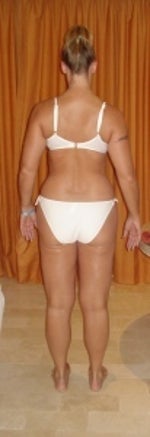Before - back