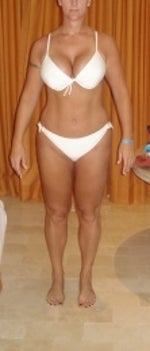Before - front
