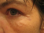 dec 8four hours post injections
