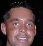 Before Sculptra
