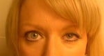 Botox droopy lid...1 week after injection