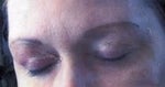Hideous tattoos.  What a mistake!  Bad blepharoplasty, too--notice thick white stripes of skin on eyelids.