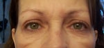 eyes