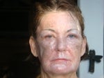 picture taken the day after Deep FX & Active FX