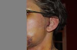 7 - 8 days after