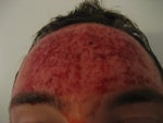 After I got home. The nurse was amazed how much I was bleeding. No pain, no gain, right?