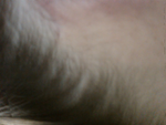 Hairline