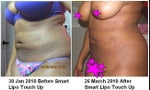26 March 2010 After Touch Up Comparison Picture