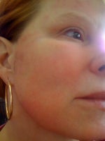 Post Pearl Day 5--much better!