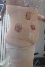 day after, swollen and with rather horrid bloody plasters...