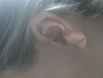 Left ear side