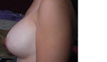 left side view smaller breast