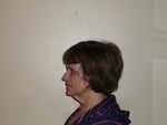 left profile - before