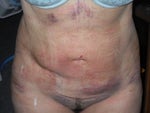 a week after