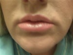 lips after prevelle silk